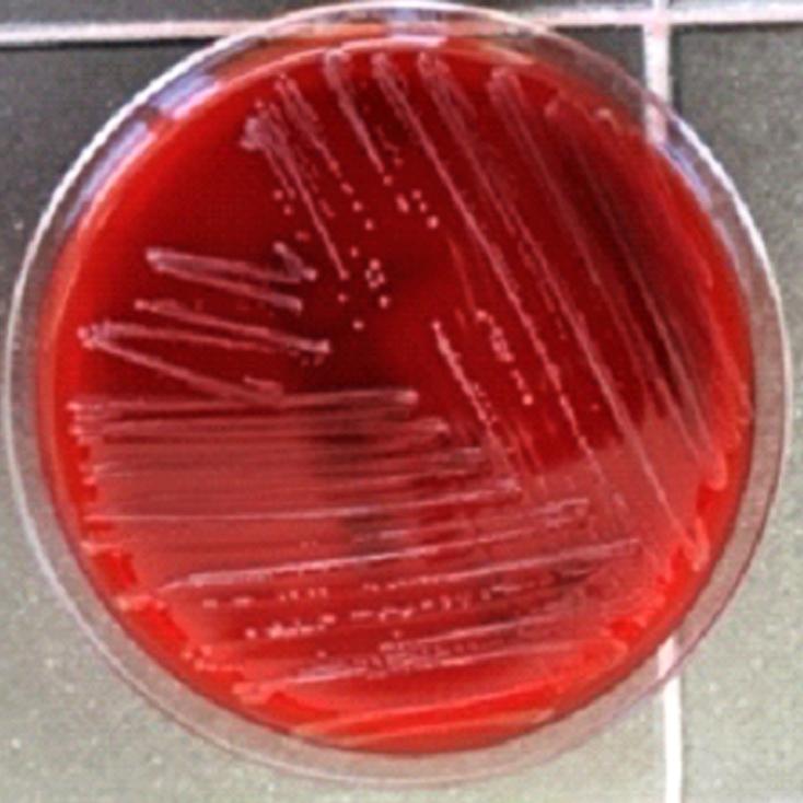 Figura 1. Crecimiento a las 24 horas en agar sangre de colonias de Pasteurella multocida. 1. Cuáles son las características microbiológicas que permiten la identificación de este género?