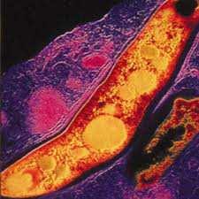 La tuberculosis (TBC) es una enfermedad producida por el Mycobacterium tuberculosis (MT), denominado
