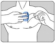 Coloque el lado adhesivo del parche sobre la parte superior o inferior de la espalda o en la parte superior del brazo o en el pecho y a continuación quite la segunda hoja de la lámina protectora.