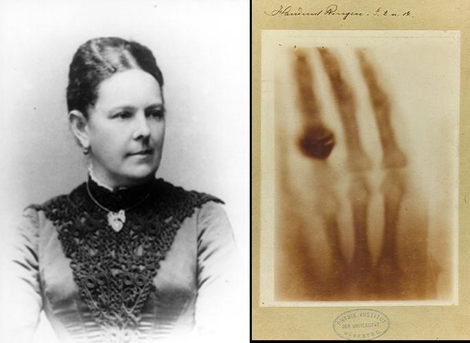 1896 Se extiende el uso de los rayos X con