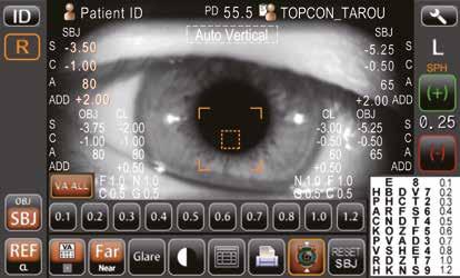 DATOS OBJETIVOS Y SUBJETIVOS La información de los dos ojos se muestra en una pantalla táctil en color de 8,5 pulgadas.