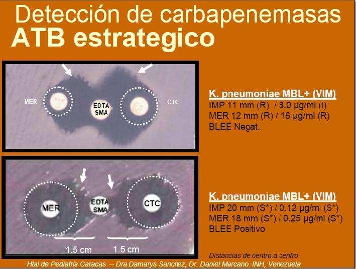 Screening metallo betalactamasa Test microbiológico aproximación de disco con EDTA o 2 mercaptopropiónico