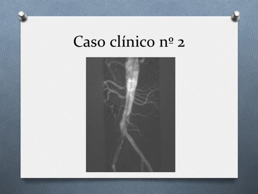 Fig. 16: Estudio control angiográfico tras la colocación de las prótesis, que
