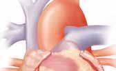 La angina y su corazón Pulmones El corazón es un músculo que bombea sangre a todo el cuerpo. Al igual que otros músculos, el corazón necesita un suministro constante de oxígeno para funcionar.