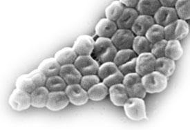 resistencia a antimicrobianos Géneros más importantes: Pseudomonas Acinetobacter