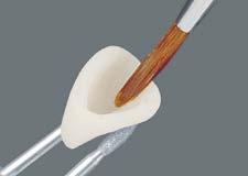 El producto facilita al protésico o al odontólogo la reproducción del color dental de forma más segura, puesto que permite controlar y, en caso necesario, corregir el color de la restauración antes