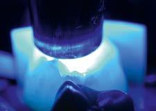Fijación adhesiva Aplicar un gel de protección antioxígeno (p. ej.
