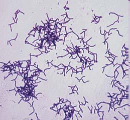 Actinomyces Estos microorganismos se encuentran formando parte de la microbiota comensal de la cavidad bucal y del tracto urogenital.