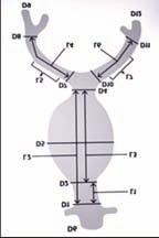 D6: diámetro de la aorta proximal normal. D4: diámetro inferior distal antes de la bifurcación biilíaca. D7: diámetro de la ilíaca primitiva derecha. D10: diámetro de ilíaca primitiva izquierda.