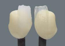Resultado de la cocción / Diseño de la estructura y grosores de capa En las cerámicas dentales, el resultado de la cocción depende en gran medida del proceso concreto de cocción aplicado por el