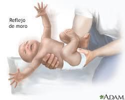 REFLEJOS Reflejo de moro: Este reflejo a menudo se denomina reflejo de sobresalto porque se produce cuando el bebé se sobresalta por un sonido o movimiento estrepitoso.