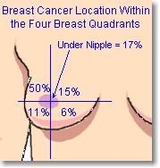 ANATOMÍA DE LA MAMA Localización del cáncer de mama dentro de los cuatro cuadrantes de la mama Bajo el pezón 17% Dividiendo el seno en cuatro partes, observamos que la mayor cantidad de