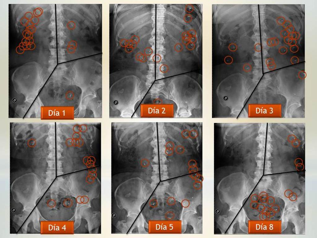 Fig. 16: Interpretación de las radiografías