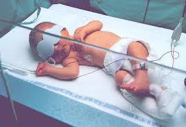 HIPERBILIRRUBINEMIA NEONATAL La ictericia en recién nacidos sucede cuando un bebé tiene un alto nivel de bilirrubina