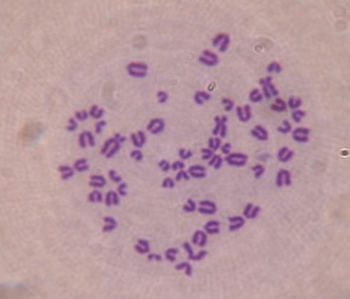 Anomalías cromosómicas relacionadas con fertilidad Líneas