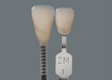 En las restauraciones de dientes anteriores altamente translúcidas y sin estructura, confeccionadas a partir de VITA