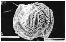 28 Figura 3. Corpúsculo de Mandl de forma poliédrica en Gymnogeophagus balzanii. Figura 4. Corpúsculo de Mandl de forma ovoide en Gymnogeophagus balzanii. Escala: 100 µm.