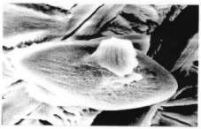 Los corpúsculos poliédricos suelen producirse por la fusión de elementos de forma cuadrangular durante su crecimiento.