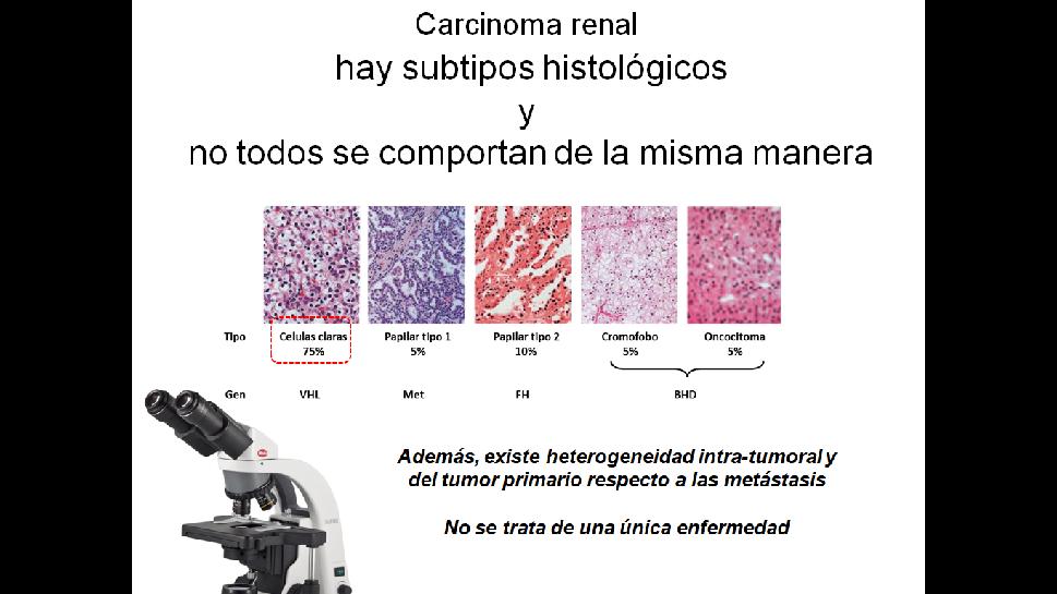 Carcinoma renal hay subtipos histológicos