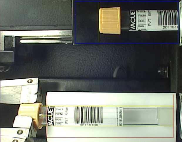 La computadora procesadora de imágenes es la responsable de reconocer el color de la tapa, detección del nivel del líquido y la determinación de la calidad de la muestra procesada.