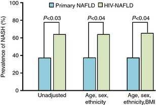 La lesión histológica en la NAFLD puede ser más grave en el paciente infectado por VIH Cross-sectional case control study 33 HIV-infected patients with