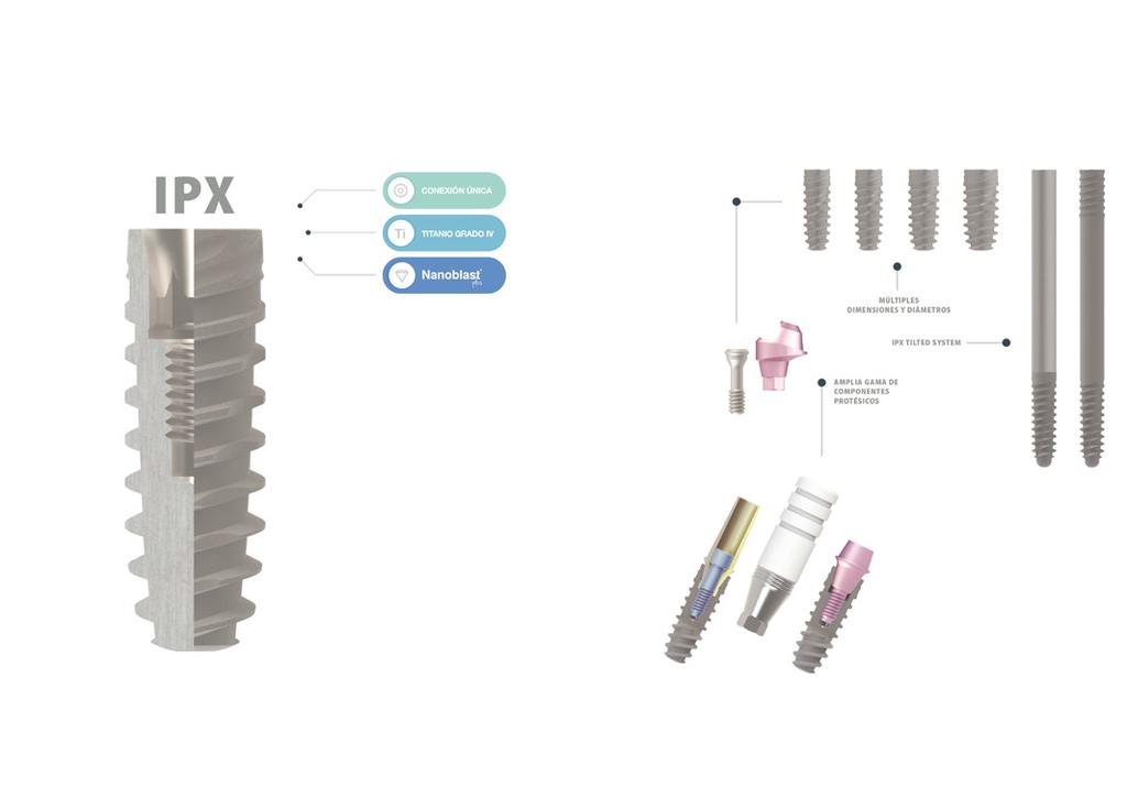 IPX CONCEPT Utiliza un diseño seguro. Un solo concepto. Implantes de conexión interna, externa, cigomáticos y especiales.
