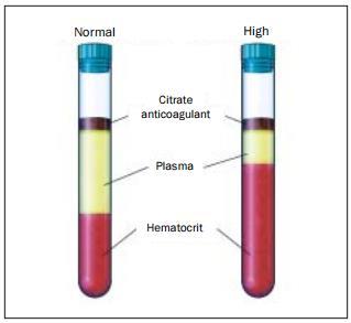 Relación Plasma/Anticoagulante Htc > 50% : Efecto de dilución Htc < 35% :