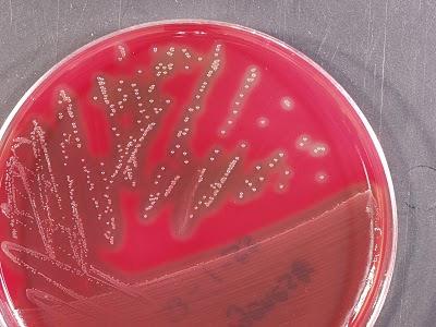 Streptococcus pyogenes Caracteristicas: Cocaceas gram positivas dispuestas en cadenas Son colonias blancas de 1-2 mm de diametro con una marcada zona beta