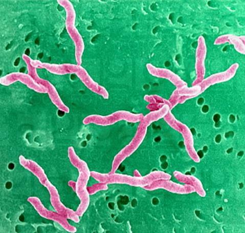 Se estima que es uno de los agentes bacterianos más frecuentes causantes de gastroenteritis. Comprende 17 especies y seis subespecies, siendo Campylobacter jejuni y C.
