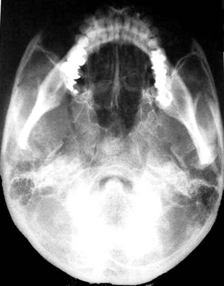 Tipos de radiografías