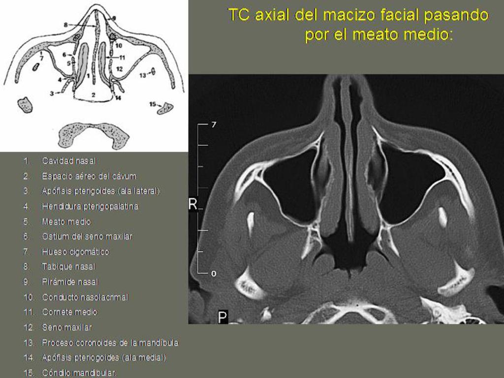 Fig. 13 Hospital La Mancha Centro -