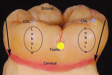 De oclusal a gingival, el diente va estrechándose hasta cervical, donde es más estrecho. Figura 43. La cara lingual es más pequeña que la V. vical, de mesial a distal, por inclinación de la corona.