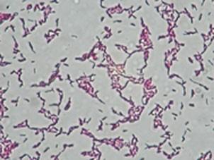 Bacteria que la produce: Mycobacterium bovis (BOVINOS)