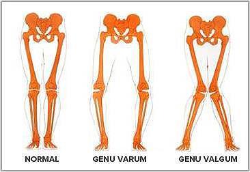 3.4 LA EXTREMIDAD INFERIOR Fémur Es el hueso más largo, más pesado y más fuerte de todos los huesos del organismo.