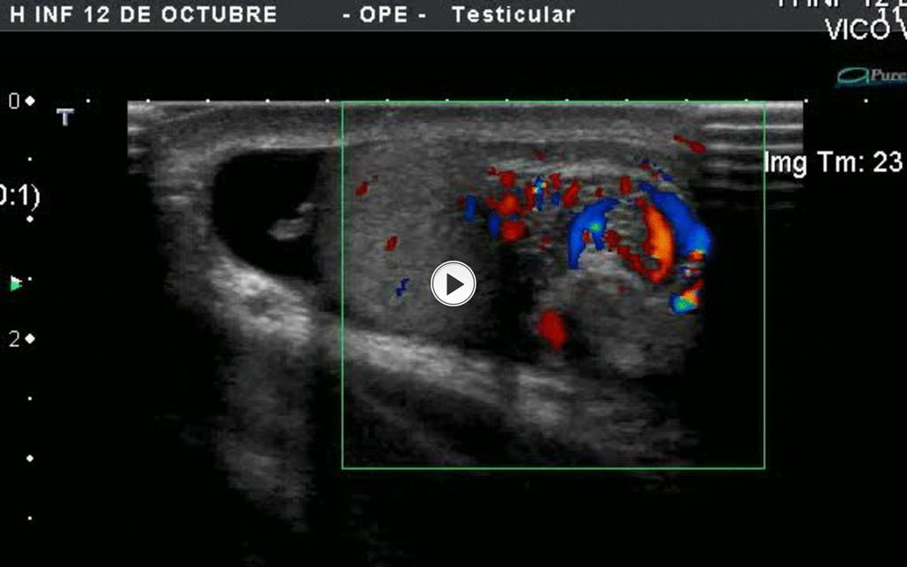 Fig. 1: Case 2:Video G. del Pozo; Radiodiagnóstico.