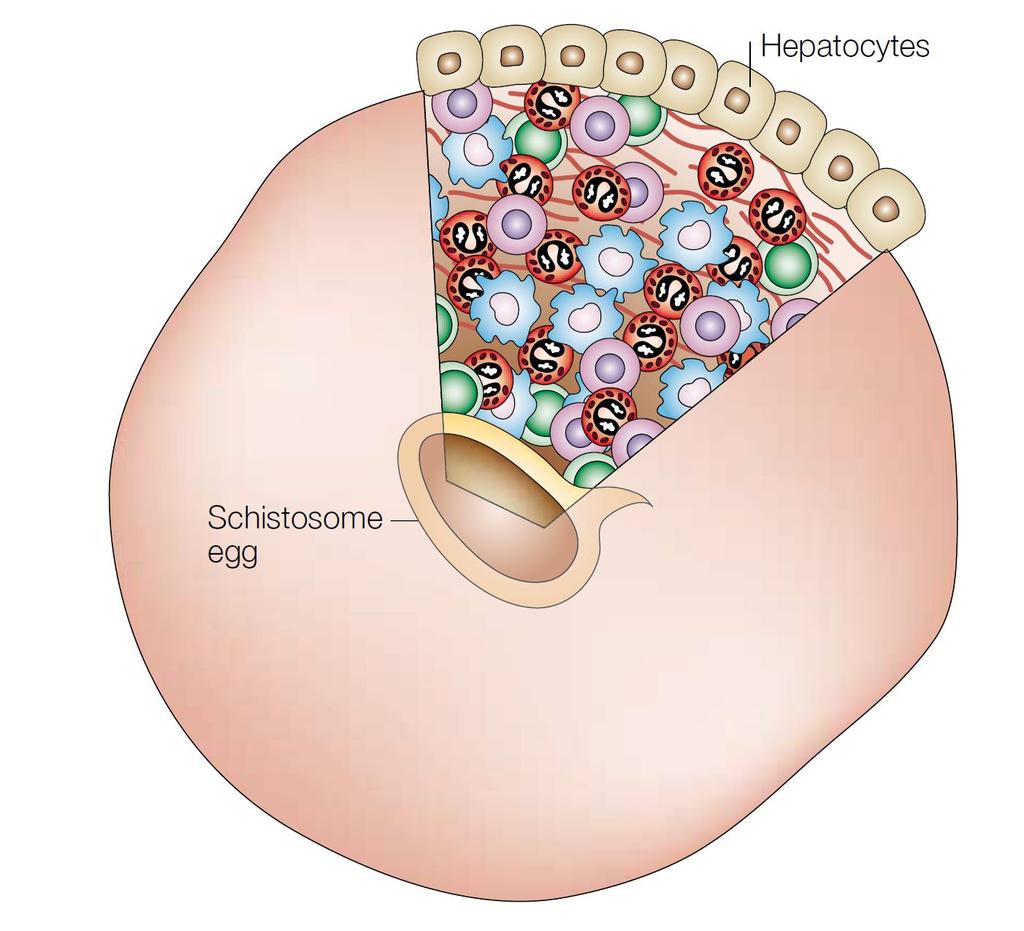 html Inmunopatología asociada Fibrosis en hígado, intestino y vejiga Hipertensión portal