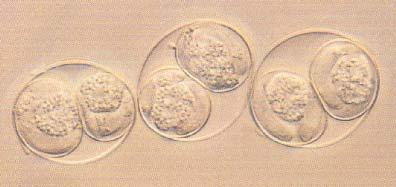 . El diagnóstico de la coccidiosis neonatal del lechón causada por Isospora suis, se basa en los signos clínicos, la historia de la granja y la demostración del parásito.