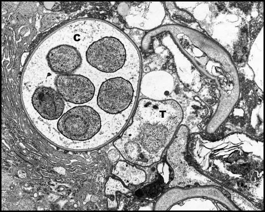 Biología Eucariote unicelular no móvil. Por criterios morfológicos: Forma trófica pequeña (1-5 μm). Agrupadas.
