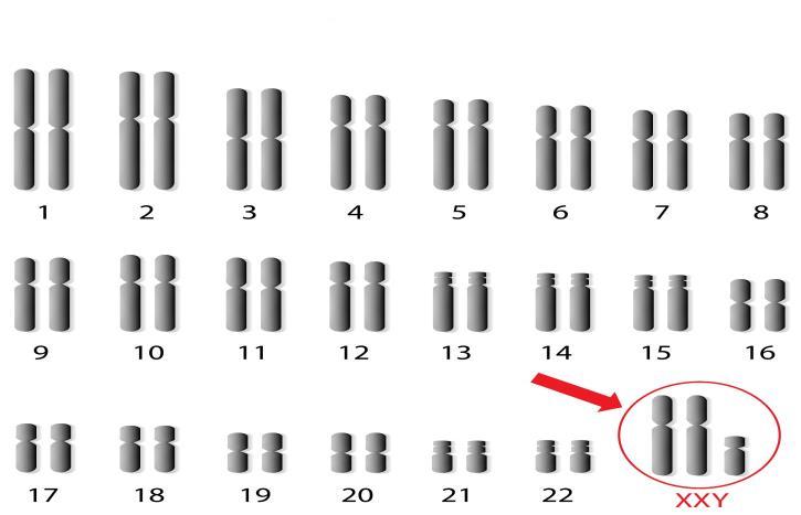 10. Observe el siguiente cariotipo humano y complete lo siguiente: N Cromosomas autosomas:.