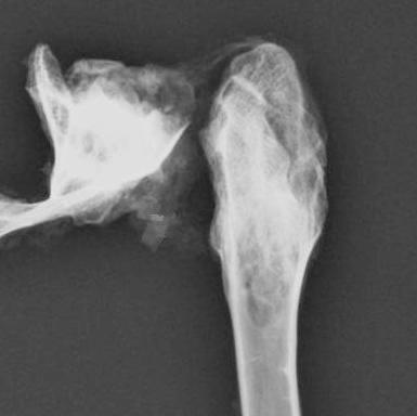 Estudio experimental de la cicatrización en la artroplastia de resección de la cadera Para el Grupo 12-G (conejos intervenidos con la técnica de resección artroplastia sin coaptación y sacrificados a