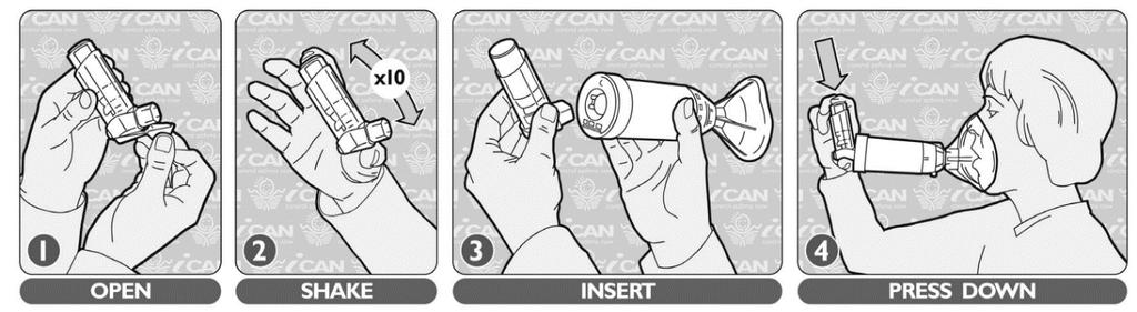 Instrucciones de uso de los dispositivos contra el asma Inhalador de dosis medida (MDI)/puffer Inhalador/puffer con espaciador y mascarilla (para menores de 4 años) 1. ABRIR 2. AGITAR 3. INSERTAR 4.