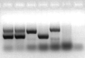 Serotipificación: O10:H PCR múltiple wzxo10/flich/ter: O10:H + / ter- PCR aggr (región del gen correspondiente al regulador de expresión AggR): + PCR pcvd32 (fragmento correspondiente a la secuencia