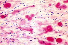 Microorganismo Sensibilidad S. pneumoniae 69-93% H. influenzae niños 50-65% H. influenzae adultos 25-33% N. meningitidis 89-49% L.