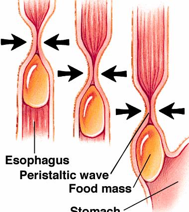 3.DEGLUCIÓN esofágica onda