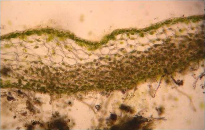 Multiestratificado o Epidermis dorsal y ventral (con poros), un cl. Por celula http://blogs.ubc.ca/biology321/files/2010/06/hornwort-thallus-cross-section.