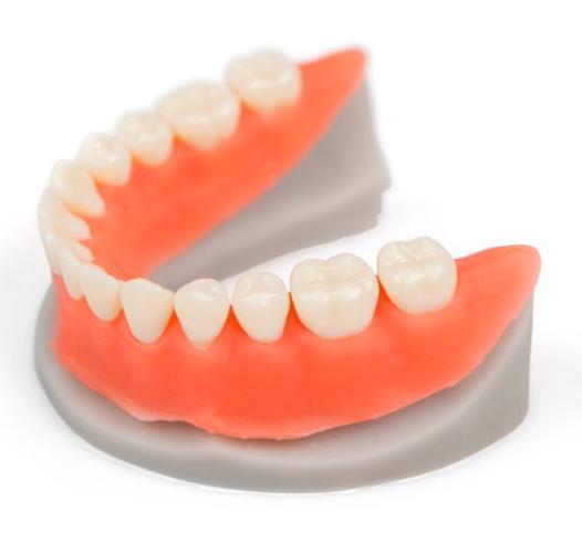 MASCARA GINGIVAL La impresión 3D DWS es capaz de reproducir de manera realista las características de gingiva y tejidos blandos: color, textura