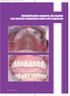 CcienciaGonza.QXP 2/4/09 16:11 Página 2. Rehabilitación completa del maxilar con prótesis cementada sobre seis implantes