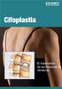 Cifoplastia. El tratamiento de las fracturas de vértebras