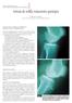 Artrosis de rodilla: tratamiento quirúrgico