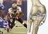 Título: Lesiones ligamentarias de rodilla en el rugby.